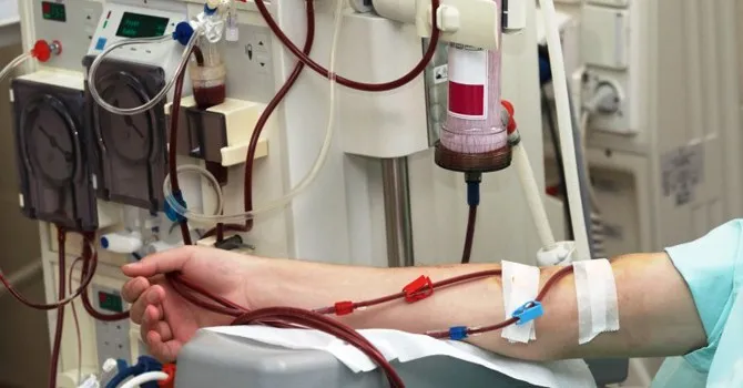 डायलासिस सेवा उपलब्ध गराउन छ जिल्लामा सेवा केन्द्र विस्तार