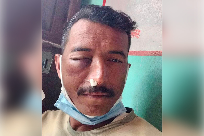 इन्सपेक्टरले कुटे प्रहरी हवल्दारलाई