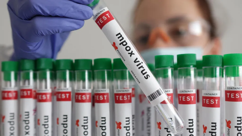 थाइल्याण्डमा पहिलो मंकिपक्स देखिएको खुलासा