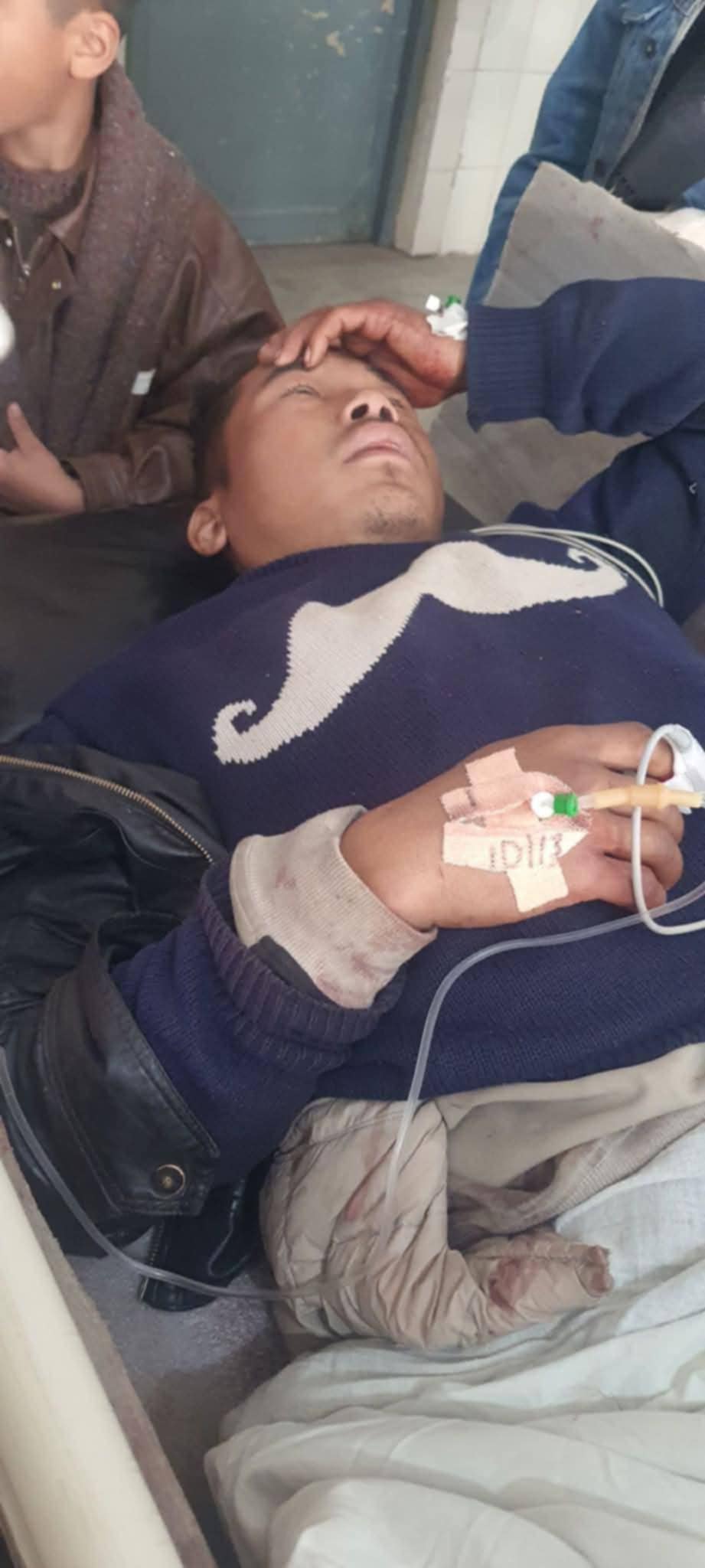 झापाको सुरुङ्गामा गोली चल्दा एक जना घाइते