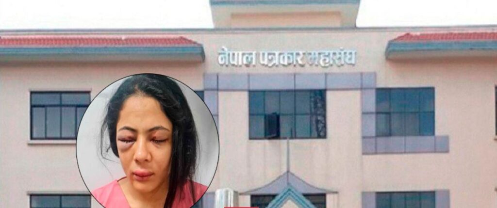 पत्रकार कार्कीमाथि भएको घटनाप्रति महासङ्घको ध्यानाकर्षण