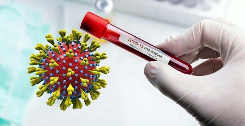 कोरोनाको जोखिम कायमै: सुदूरपश्चिममा सङ्क्रमितको सङ्ख्या बढ्दै